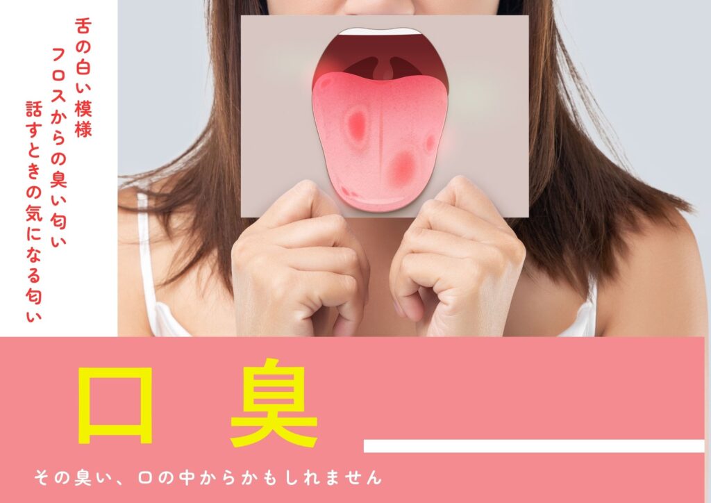 口臭 コラム