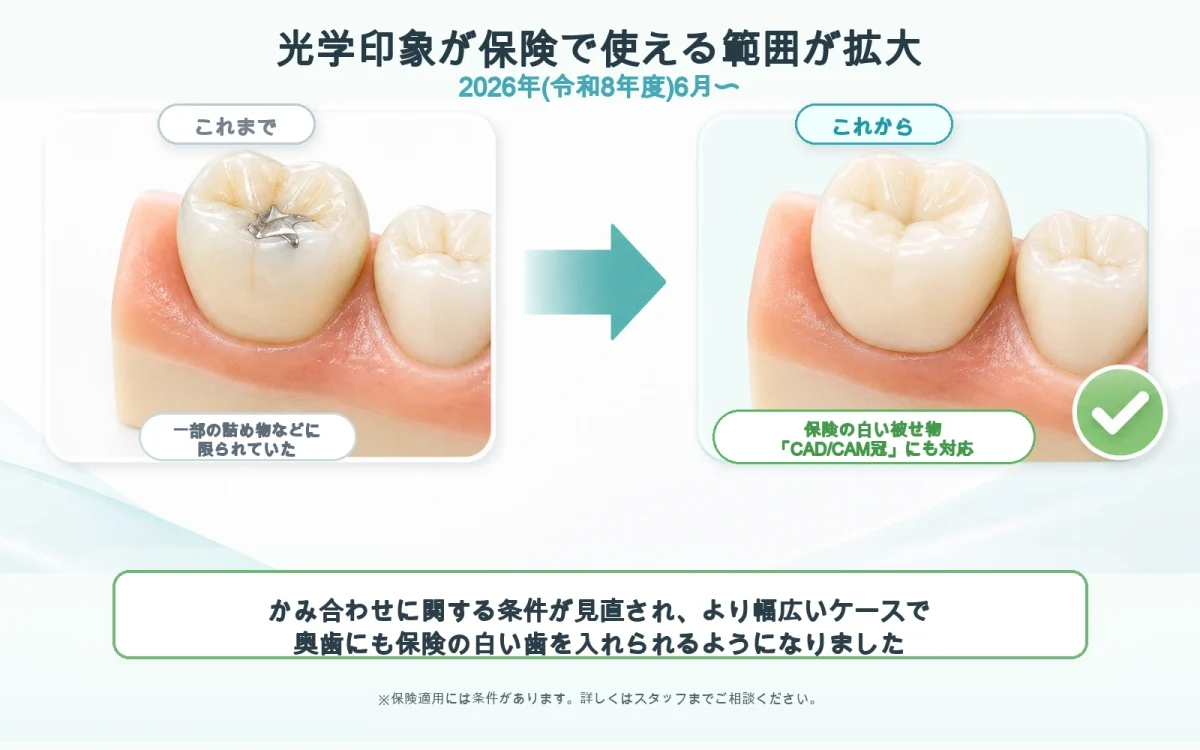 光学印象　保険適応拡大